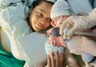 Morre o segundo gêmeo siamês de Canarana (MT) que nasceu em Goiânia